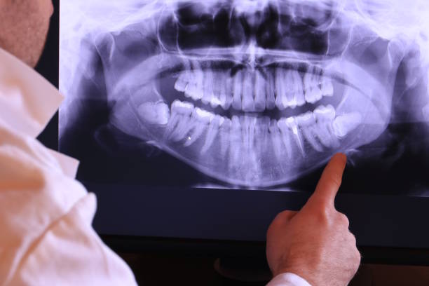 Best Pediatric Emergency Dentist in Chesaning, MI