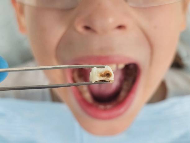 Best Weekend Emergency Dentist in Chesaning, MI